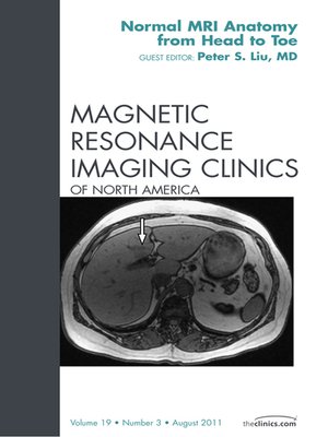 cover image of Normal MR Anatomy, an Issue of Magnetic Resonance Imaging Clinics